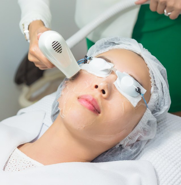 PHOTOFACIAL IPL SR Duluth Medspa by Aging Young