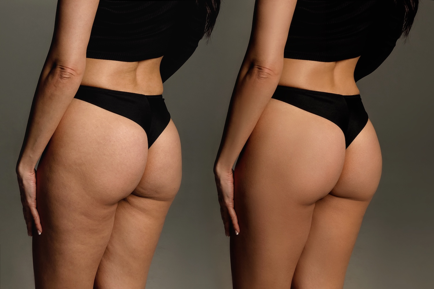 Side-by-side back view of a person wearing black underwear, showing two similar poses with visible differences in skin texture.