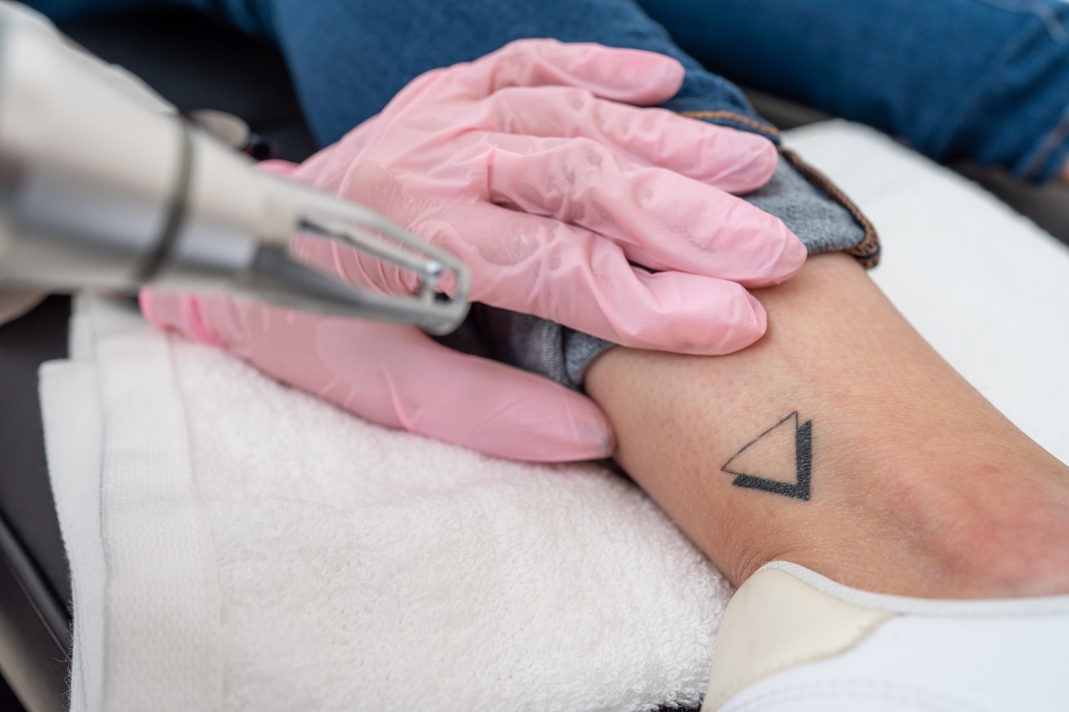 Gloved hands using laser device on wrist with small tattoo