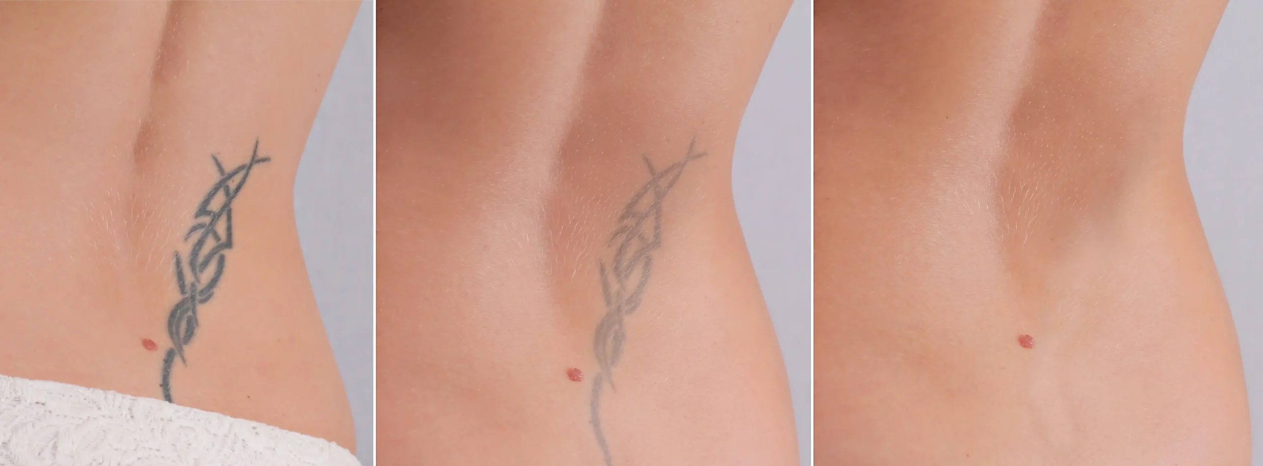 Three-panel comparison showing a tattoo appearing darker on the left and lighter toward the right