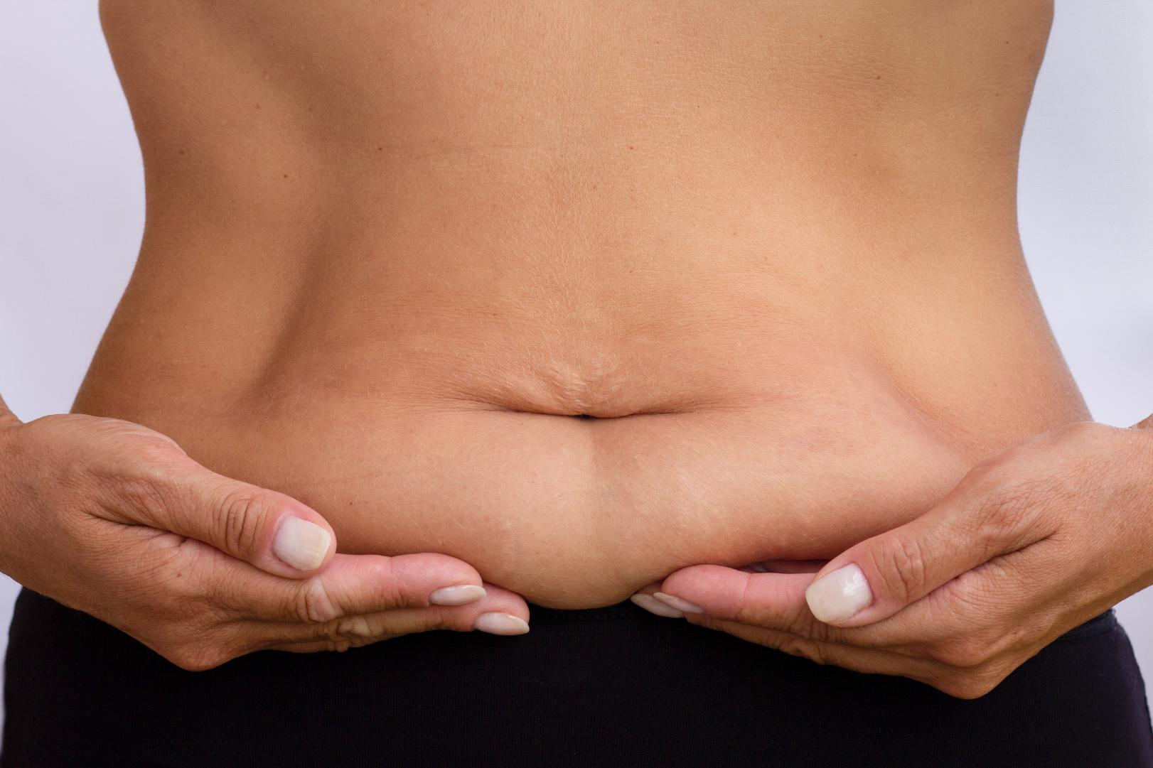 Hands gently hold loose skin on the lower abdomen against a plain background.